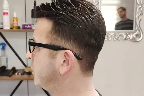 Aurahair protez saç merkezi - Resim 18