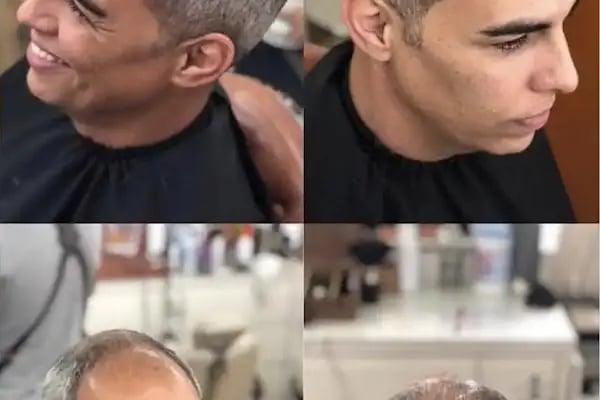 Aurahair protez saç merkezi - Resim 6