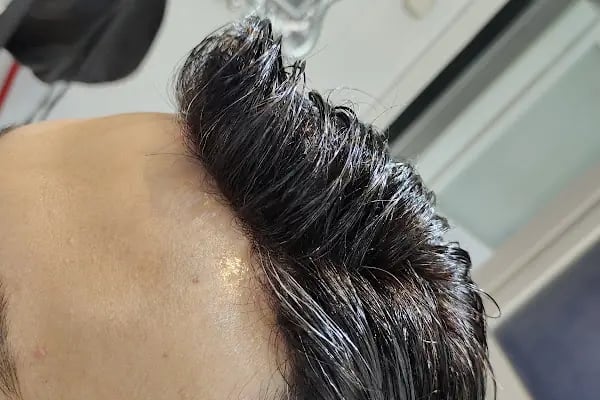 Aurahair protez saç merkezi - Resim 2