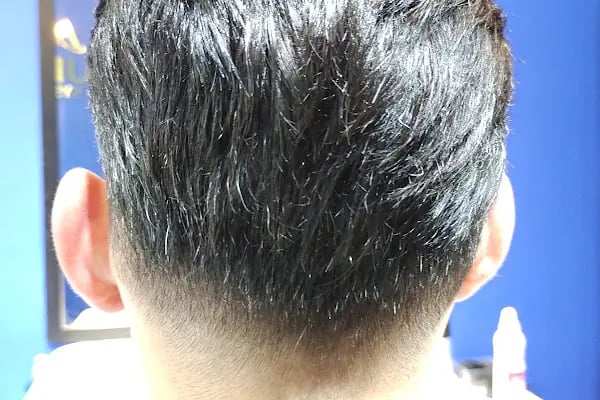 Aurahair protez saç merkezi - Resim 16