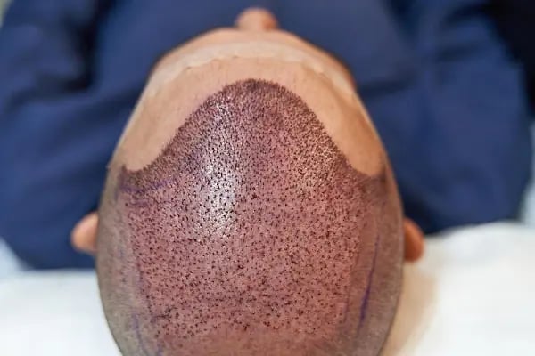 Esthetism Health - Resim 3