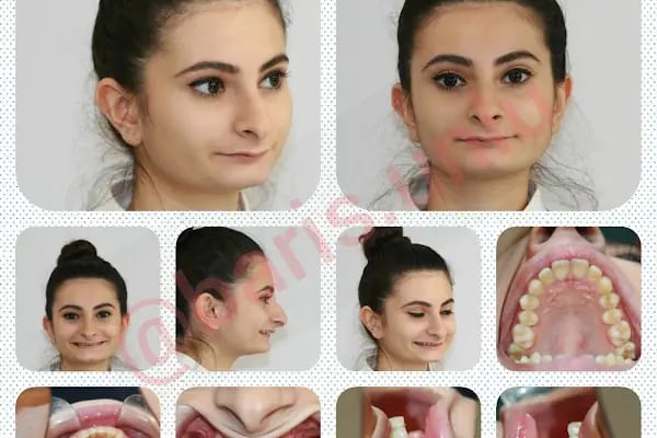 Ortodontist Diş Kliniği - Resim 12