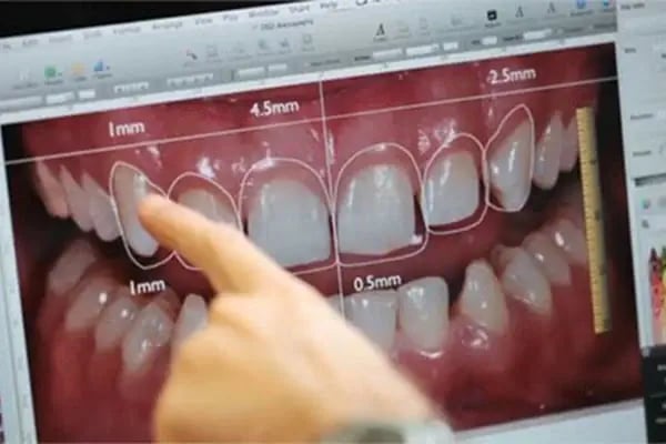 Estetik A Ağız ve Diş Sağlığı Polikliniği - Resim 11