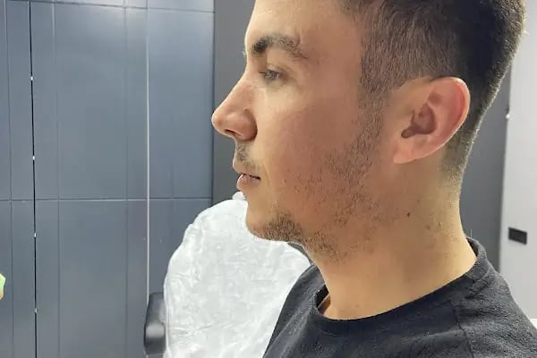 SAMED DOĞAN Lazer Epilasyon &amp; Cilt Bakımı - Resim 3