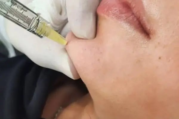Dr. Civaş &amp; Dr. Akpınar | Dermatoloji - Saç Ekimi - Resim 6
