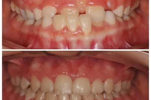 BULUT DENTAL DİŞ POLİKLİNİĞİ (İMPLANT ve ORTODONTİ KLİNİĞİ) - Resim 13