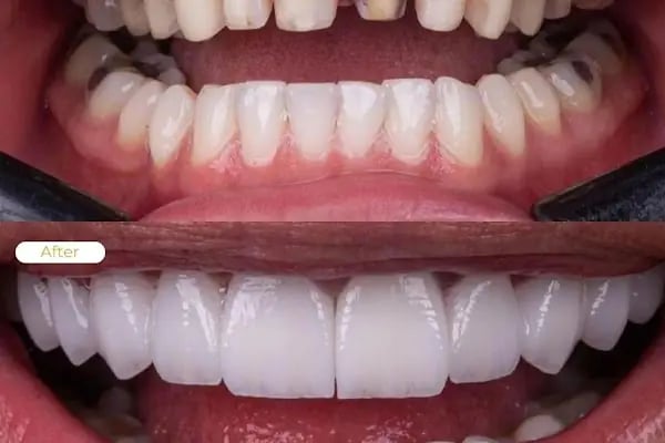 Astradent Ağız ve Diş Sağlığı Polikliniği - Resim 10