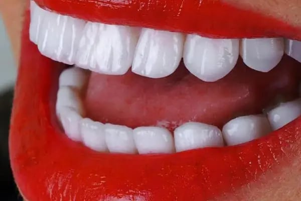 Astradent Ağız ve Diş Sağlığı Polikliniği - Resim 12