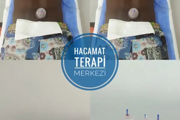 Hacamat Terapi Merkezi / Hacamat ve Sülük Tedavisi - Resim 7