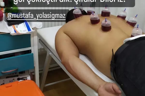 Hacamat Terapi Merkezi / Hacamat ve Sülük Tedavisi - Resim 6