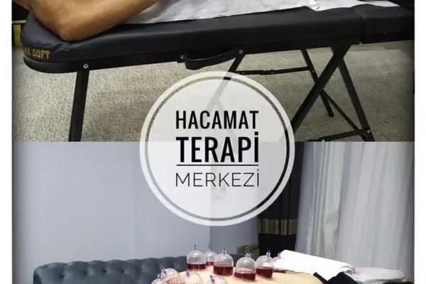Hacamat Terapi Merkezi / Hacamat ve Sülük Tedavisi - Resim 5
