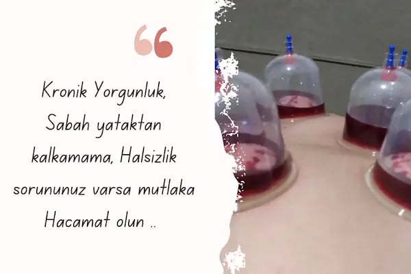 Hacamat Terapi Merkezi / Hacamat ve Sülük Tedavisi - Resim 9