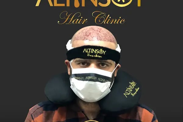 Trabzon Saç Ekim Merkezi Saç PRP`si | Altınsoy Hair Clinic - Resim 16
