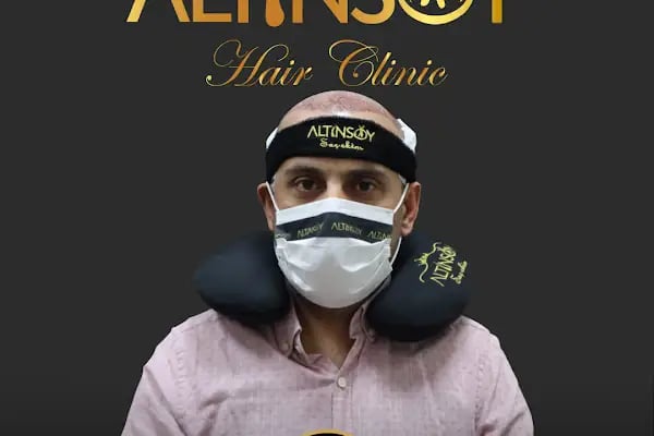 Trabzon Saç Ekim Merkezi Saç PRP`si | Altınsoy Hair Clinic - Resim 9