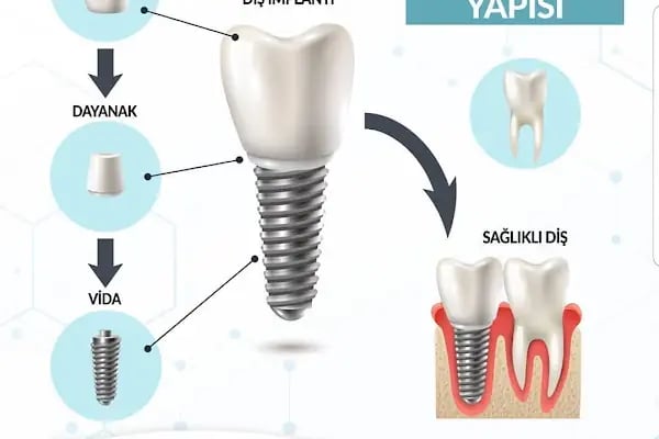 Özel Gazi Ata Ağız ve Diş Sağlığı Polikliniği Gaziemir - Resim 15