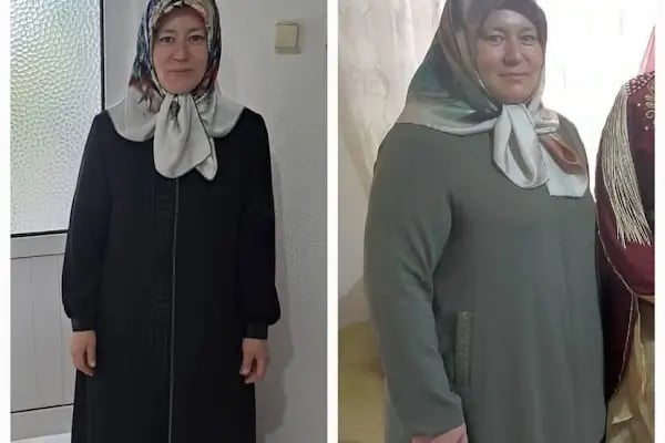 Uzman Diyetisyen Gizem Dinç,Beslenme ve Diyet Danışmanlık Merkezi - Resim 4