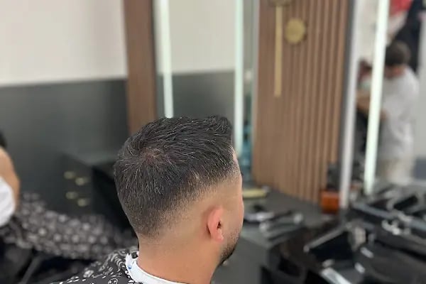 Halil Banar Hair Center - Resim 6