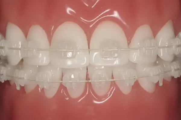ARTI ORTODONTİ ESTETİK AĞIZ VE DİŞ SAĞLIĞI POLİKLİNİĞİ - Resim 15