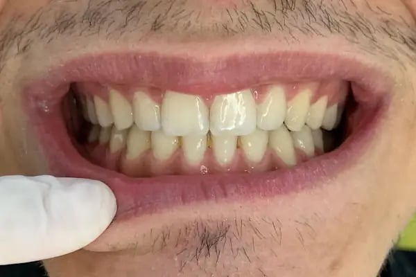 ARTI ORTODONTİ ESTETİK AĞIZ VE DİŞ SAĞLIĞI POLİKLİNİĞİ - Resim 9