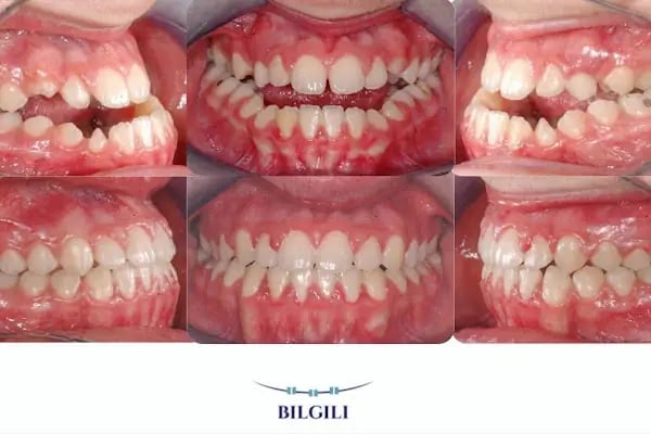 ARTI ORTODONTİ ESTETİK AĞIZ VE DİŞ SAĞLIĞI POLİKLİNİĞİ - Resim 8
