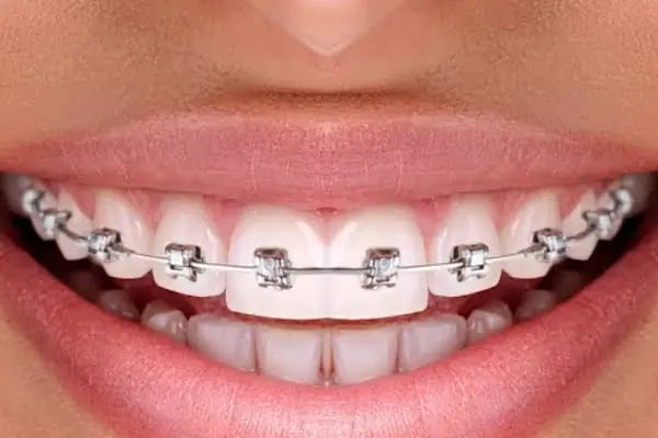 ARTI ORTODONTİ ESTETİK AĞIZ VE DİŞ SAĞLIĞI POLİKLİNİĞİ - Resim 17