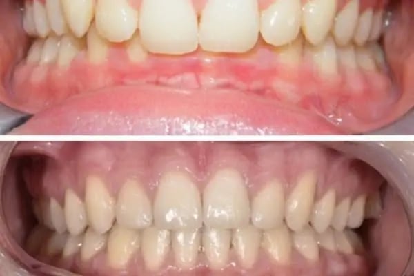 ARTI ORTODONTİ ESTETİK AĞIZ VE DİŞ SAĞLIĞI POLİKLİNİĞİ - Resim 18