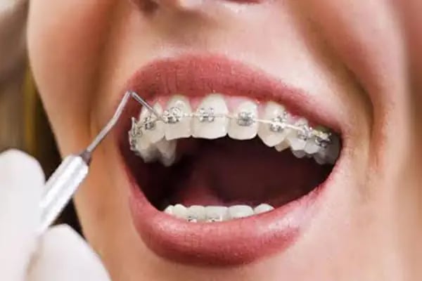 ARTI ORTODONTİ ESTETİK AĞIZ VE DİŞ SAĞLIĞI POLİKLİNİĞİ - Resim 19