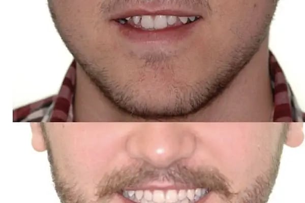 ARTI ORTODONTİ ESTETİK AĞIZ VE DİŞ SAĞLIĞI POLİKLİNİĞİ - Resim 13