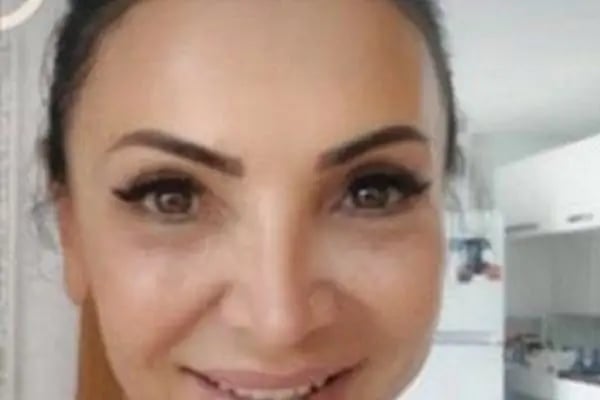 Op. Dr. Mehmet Vural Göz VE Estetik Kliniği - Resim 11