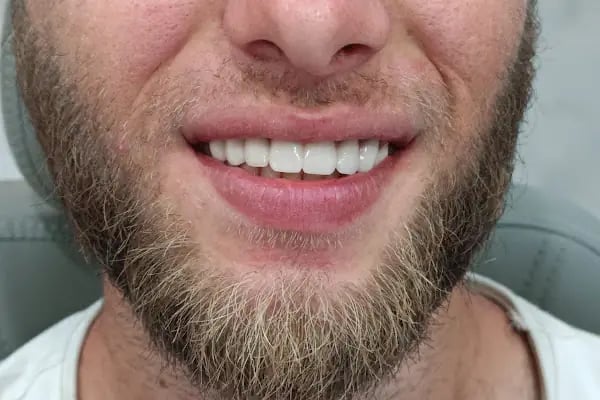 Özel Başiskele Ahmet Melih Bozoğlu Diş Kliniği - Resim 7