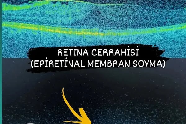 OP.DR. AHMET EROĞLU GÖZ HASTALIKLARI VE CERRAHİSİ UZMANI - Resim 17