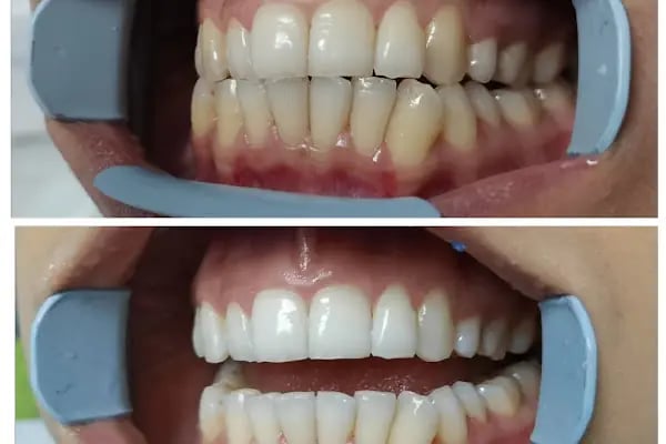 Diş Hekimi Gökhan Düşünmez - Resim 14