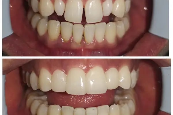 Diş Hekimi Gökhan Düşünmez - Resim 17