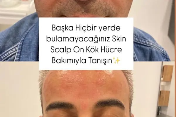 S Clinic Diyarbakır - Saç Çoğaltma, Saç Bakım ve Güzellik Merkezi - Resim 2
