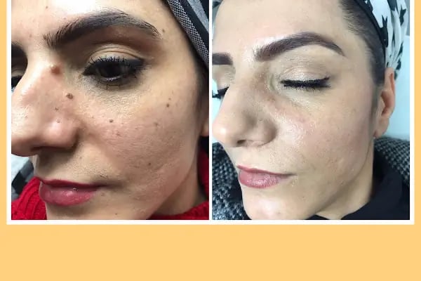 Aysel Baran Güzellik Salonu - Resim 14