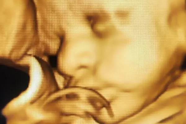 Doç. Dr. Betül YAKIŞTIRAN - Resim 6