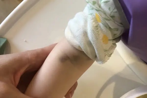 Başkent Üniversitesi Kemal Reisoğlu Hastanesi Acil Servisi - Resim 8