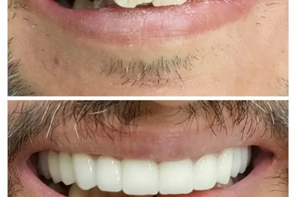 Ahsen Ağız ve Diş Sağlığı Polikliniği - Resim 12