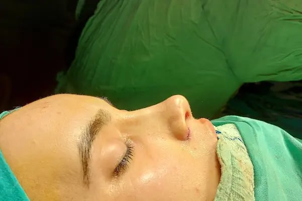 Doç. Dr. Burhan Özalp - Plastik ve Estetik Cerrahi Uzmanı - Resim 8