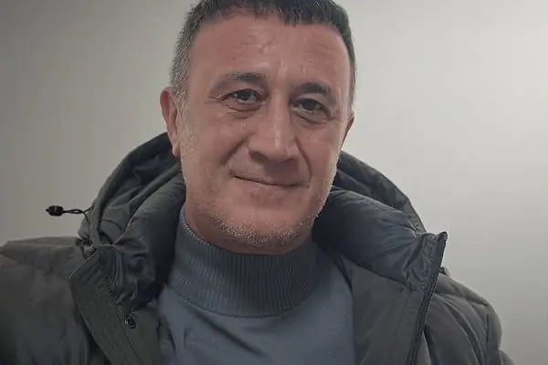Ahmet Arslan Hair Transplant - Ankara Saç Ekimi - PRP - Resim 7
