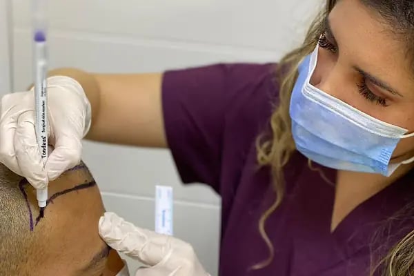 A Plus Hair Transplant &amp; Hair Clinic Saç Ekim Merkezi - Resim 12