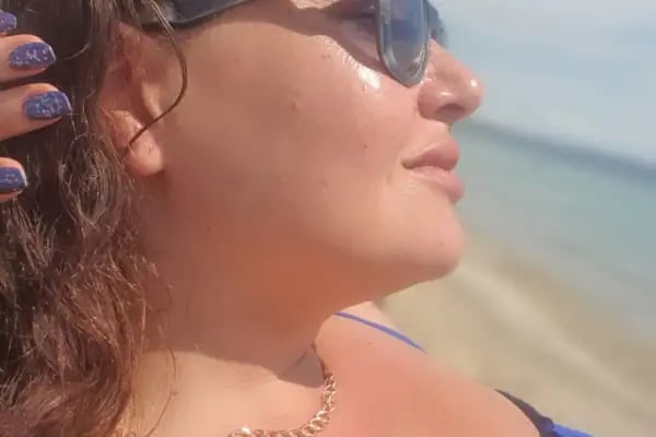 Uzm.Dr.Eda Özkara Mersinlioğlu - Dudak Dolgusu - Burun Dolgusu - Botoks - Gençlik Aşısı - Eksozom Tedavisi - Saç Mezoterapisi - Resim 13