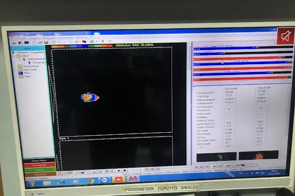 Ekspermed Ortopedi Medikal Sağlık Ürünleri - Resim 4