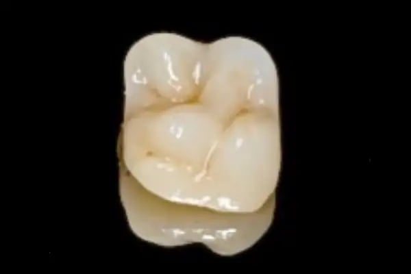 DigitalDent Ağız ve Diş Sağlığı Polikliniği - Resim 19