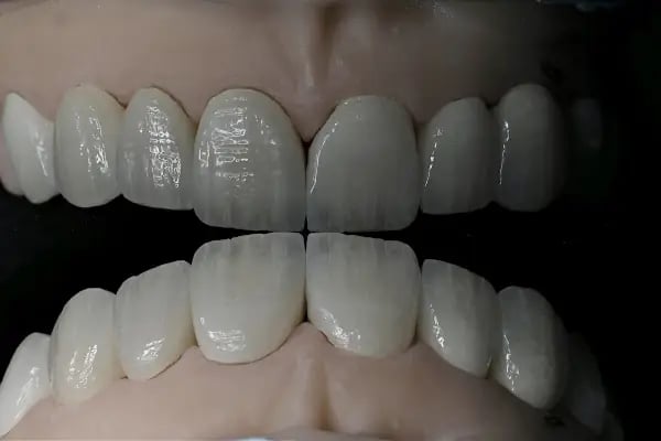 DigitalDent Ağız ve Diş Sağlığı Polikliniği - Resim 15