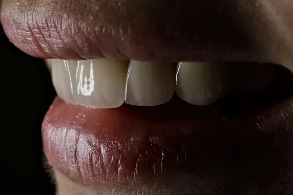 DigitalDent Ağız ve Diş Sağlığı Polikliniği - Resim 18
