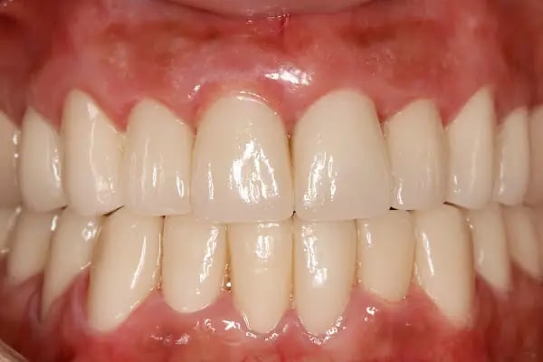 DigitalDent Ağız ve Diş Sağlığı Polikliniği - Resim 17