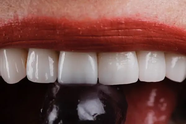 DigitalDent Ağız ve Diş Sağlığı Polikliniği - Resim 10