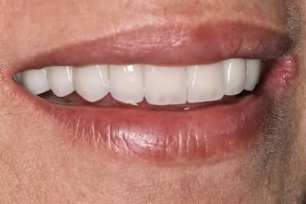 DigitalDent Ağız ve Diş Sağlığı Polikliniği - Resim 12