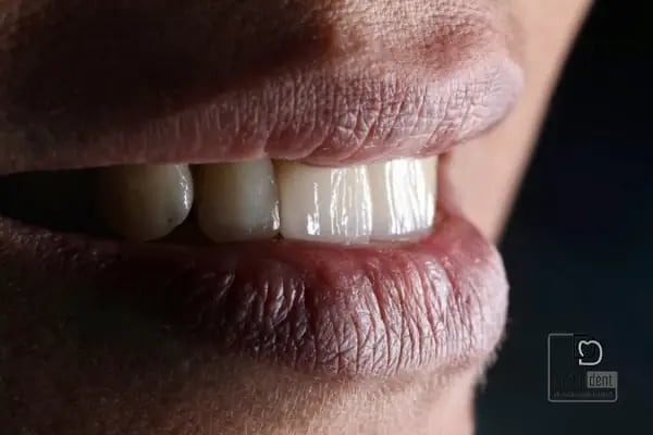 DigitalDent Ağız ve Diş Sağlığı Polikliniği - Resim 11